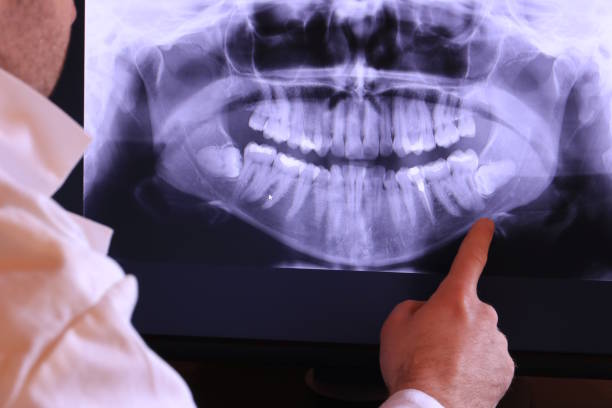 Best After-Hours Emergency Dentist in Park Ridge, IL