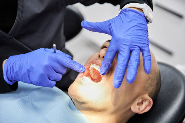 Best Emergency Wisdom Teeth Removal in Park Ridge, IL