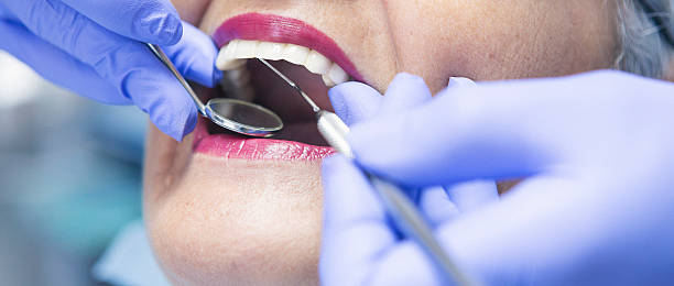 Best Emergency Broken Tooth Repair in Park Ridge, IL